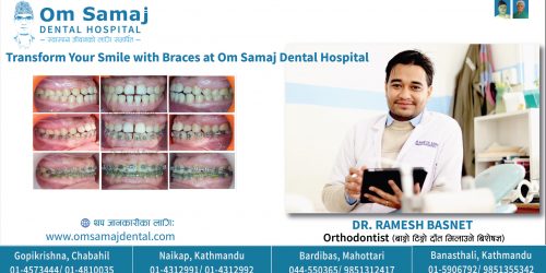 article bad breath-01